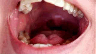 Check my Red Tonsils
