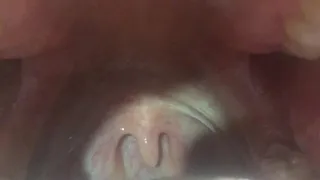 Playing with uvula