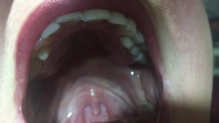 6 minutes of yawning and showing my uvula