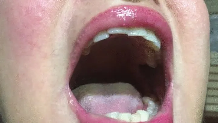 Open your mouth and say UVULA!!!