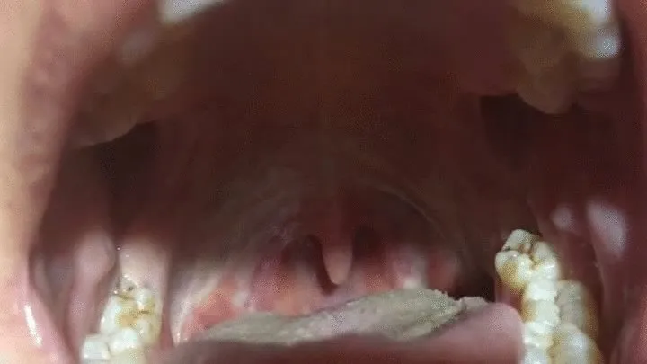 Say AAAAHHHH and show uvula!!!!