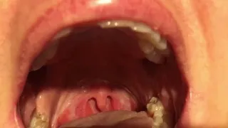 Playing with uvula!!! Aaaaaaaahhhhhh