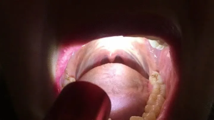 Yawning and revealing dancing uvula with the help of a flashlight!