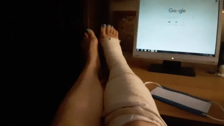 SPRAINED ANKLE GIVES ME AN ORGASM