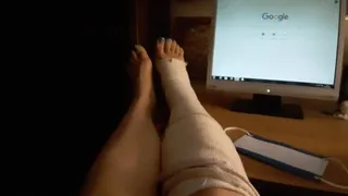 SPRAINED ANKLE GIVES ME AN ORGASM