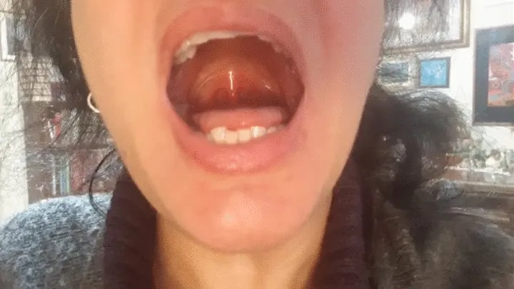 DANCING UVULA!