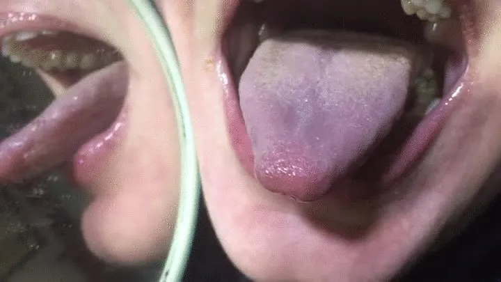 Uvula dancing and tongue!