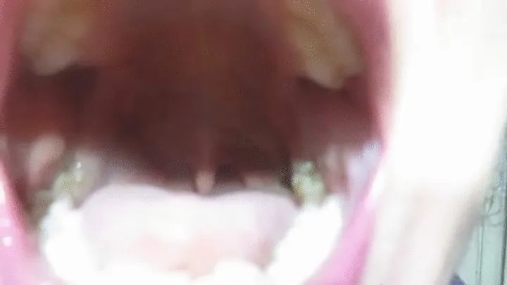 Say aaahhhh and show uvula!