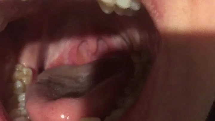 Extreme close up of uvula and mouth!