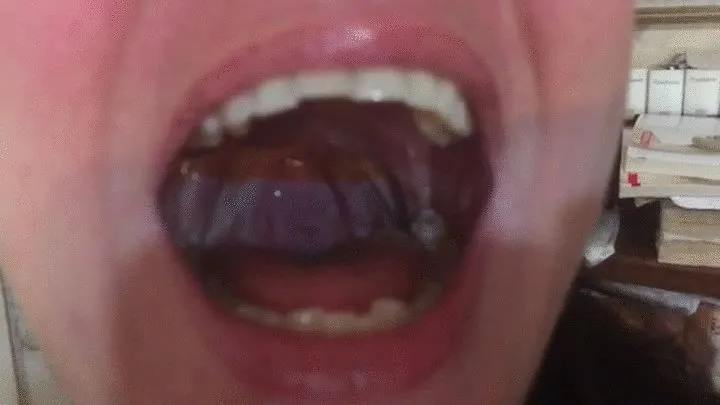 Yawning and showing uvula