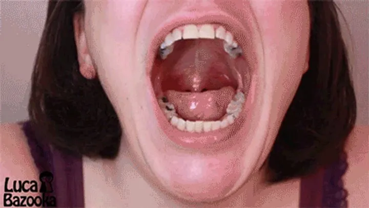 Inside My Mouth