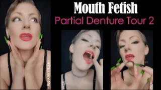 Mouth Fetish: Partial Denture Tour 2 - vertical
