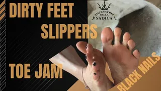 Dirty feet, slippers toe print, toe jam