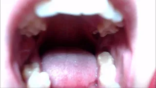 Inside Of My Mouth #2
