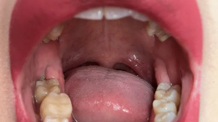 Inside of My Mouth Before You Get in There