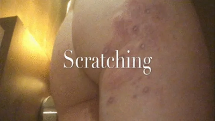 Scratching Urticaria