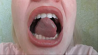 Large mouth without Palatine tonsils!