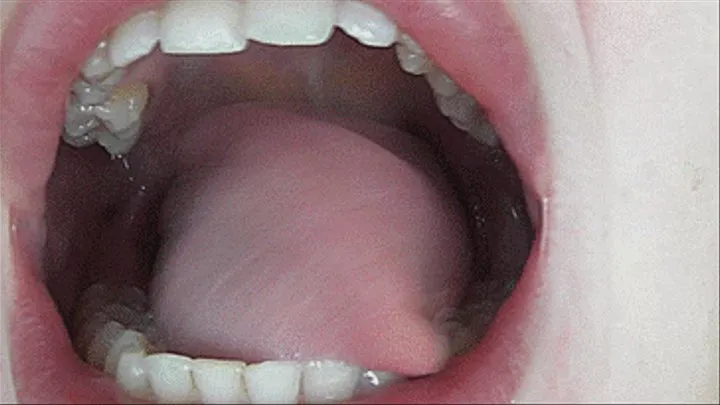 Large throat without tonsils!