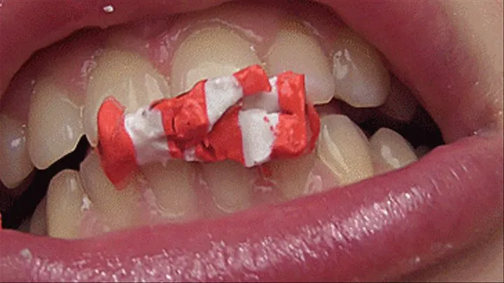 REQUEST White teeth bite different elastic bands!