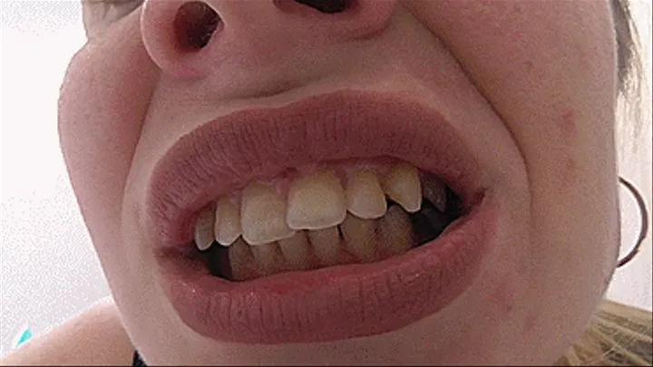 YELLOW UNEVEN TEETH BITE!