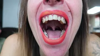 Silent Uvula