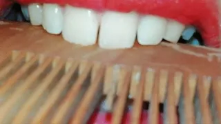 teeth Marks
