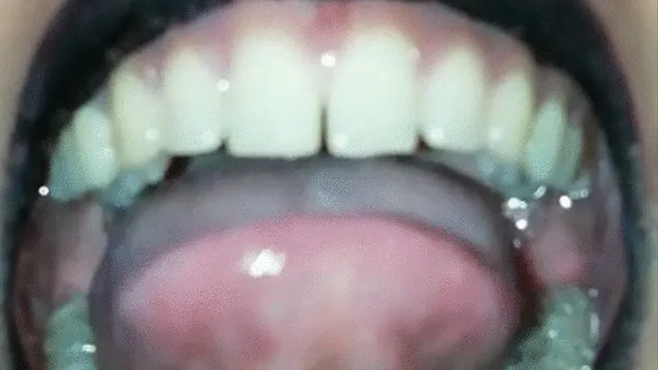 white tongue