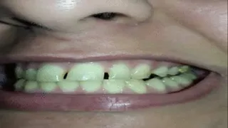 show teeth