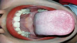 My Tongue 2