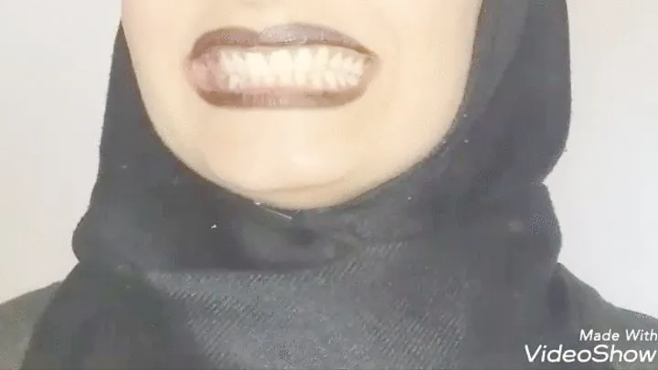 Teeth marks 2