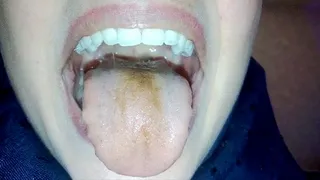 my tongue and uvula