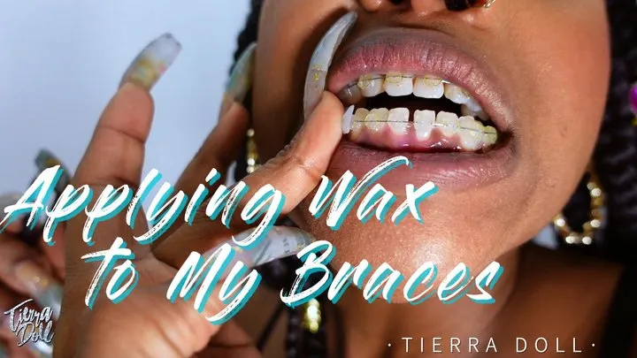 Applying Wax to My Braces