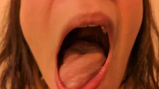 ORAL EXAMINATION: FRESH MOUTH | Miinxiiee