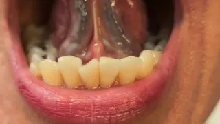 ORAL EXAMINATION | Elaine