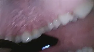 Eating a Cookie REVERSE ENDOSCOPE