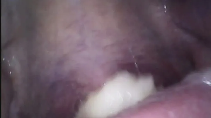 Becca Chews and Swallows RAW ENDOSCOPE FOOTAGE