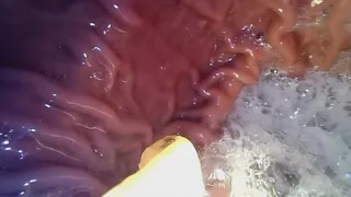 New Endoscope Test Footage