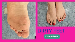 Dirty feet