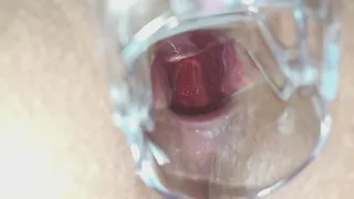 Endoscopy in my pussy and ass holes so wet and hot