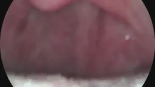 ENDOSCOPE!!! who wants to cum deep into my throat and uvula